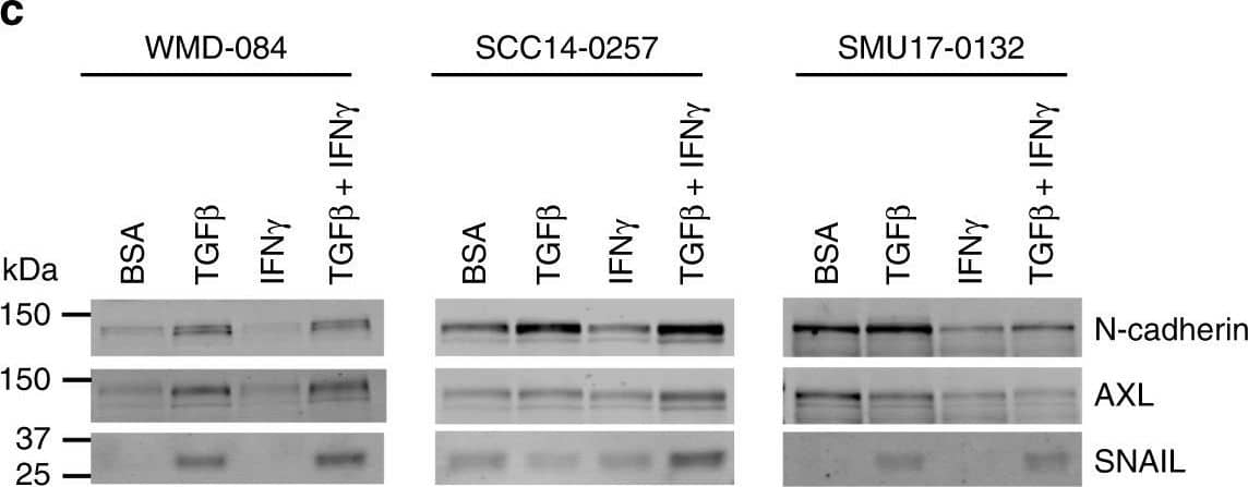 <b>Biological Strategies Validation. </b>TGF beta  promotes HLA-ABC downregulation at baseline and in response to IFN gamma .a IFN gamma -mediated induction (IFN gamma -treated/vehicle-treated control) of cell surface HLA-ABC in MITFhigh/AXLlow or /MITFlow/AXLhigh short-term PD-1 PROG melanoma cell lines. Each dot represents one cell line and HLA-ABC induction was measured by flow cytometry 24 h after treating cultures with vehicle control or 1000 U/ml IFN gamma . Box plots show the median and interquartile ranges, and data were compared using Mann-Whitney test. b Cell surface expression (median fluorescence intensity; MFI) of HLA-ABC in WMD-084, SCC14-0257 and SMU17-0132 melanoma cells treated with vehicle (Control), 1000 U/ml IFN gamma  and/or 10 ng/ml TGF beta  for 72 h. Data (mean ± s.d.) were compared using one-way ANOVA with the Geisser-Greenhouse correction. c Expression of de-differentiation markers AXL, N-cadherin and SNAIL in WMD-084, SCC14-0257 and SMU17-0132 melanoma cells treated with vehicle (Control), 1000 U/ml IFN gamma - and/or 10 ng/ml TGF beta  for 72 h. d IFN gamma  production after co-culture of TGF beta  pre-treated (10 ng/ml for 72 h) melanoma cells with the patient-matched tumor-infiltrating lymphocytes expanded from the same tumor biopsy. IFN gamma  was measured by flow cytometry. Data (mean ± s.d.) show relative IFN gamma  expression in T cells (TGF beta  pre-treated/BSA pre-treated) after background subtraction (spontaneous IFN gamma  production on immune cell-only cultures). Paired BSA-treated vs TGF beta -treated data were compared using paired t-test, **p < 0.01, *p < 0.05. Image collected and cropped by CiteAb from the following publication (//pubmed.ncbi.nlm.nih.gov/32312968), licensed under a CC-BY license. Not internally tested by R&D Systems.
