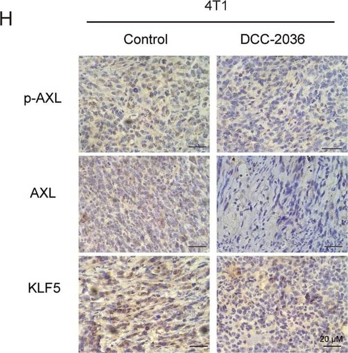 DCC-2036 inhibits CSCs in vivo according to the limited dilution assay by pretreating 4T1 cells with DCC-2036 or DMSO for 48 h.A In vivo tumorigenicity assay with limited dilution using DMSO or DCC-2036 treated 4T1 cells respectively: 200,000 (n = 7 and 8), 20,000 (n = 9 and 8), or 2000 (n = 10 and 10) cells per injection site. The frequency of BCSCs was calculated by ELDA. B Weight variation of mice following transplant of 4T1 cells into BALB/C mice after 7 days. C Images of tumor formation in BALB/C mice. D, E Transplanted tumors were harvested, and the tumor size and weight were measured at the end of the experiment. The statistical significance was determined by Student’s t-test. F Tumor-free survival curve of BALB/C mice is shown. G Hematoxylin and eosin (H&E) staining indicates the histology of tumor tissues. Scale bars, 20 μm. H Immunohistochemical analysis using p-AXL, AXL, and KLF5 antibodies in xenograft tissues from BALB/C mice. Scale bars, 20 μm. I Immunoblot of transplanted tumors from BALB/C mice posterior to the experiments. C means Control, T means DCC-2036. We chose the tumor tissues randomly for H&E staining, immunohistochemical analysis, and immunoblotting. Image collected and cropped by CiteAb from the following open publication (//pubmed.ncbi.nlm.nih.gov/36042208), licensed under a CC-BY license. Not internally tested by R&D Systems.
