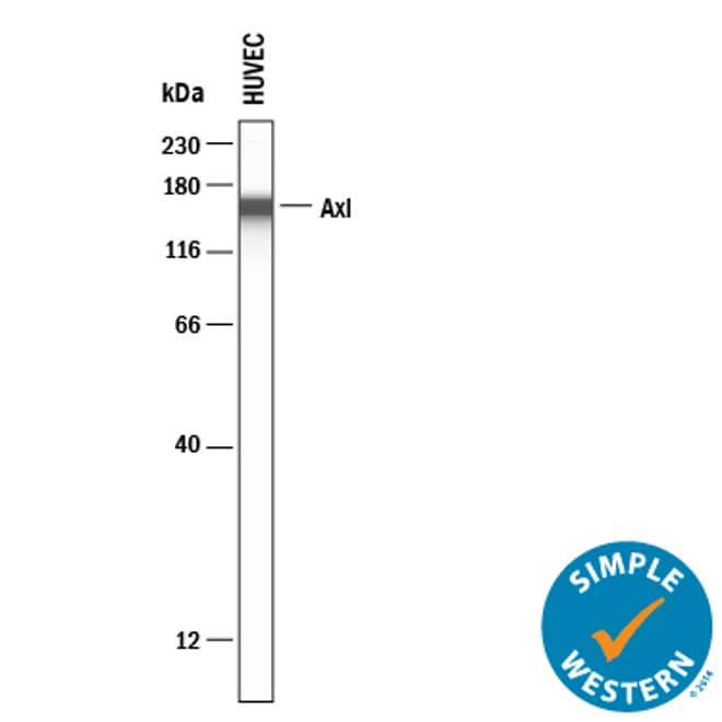 TGF beta  promotes HLA-ABC downregulation at baseline and in response to IFN gamma .a IFN gamma -mediated induction (IFN gamma -treated/vehicle-treated control) of cell surface HLA-ABC in MITFhigh/AXLlow or /MITFlow/AXLhigh short-term PD-1 PROG melanoma cell lines. Each dot represents one cell line and HLA-ABC induction was measured by flow cytometry 24 h after treating cultures with vehicle control or 1000 U/ml IFN gamma . Box plots show the median and interquartile ranges, and data were compared using Mann-Whitney test. b Cell surface expression (median fluorescence intensity; MFI) of HLA-ABC in WMD-084, SCC14-0257 and SMU17-0132 melanoma cells treated with vehicle (Control), 1000 U/ml IFN gamma  and/or 10 ng/ml TGF beta  for 72 h. Data (mean ± s.d.) were compared using one-way ANOVA with the Geisser-Greenhouse correction. c Expression of de-differentiation markers AXL, N-cadherin and SNAIL in WMD-084, SCC14-0257 and SMU17-0132 melanoma cells treated with vehicle (Control), 1000 U/ml IFN gamma - and/or 10 ng/ml TGF beta  for 72 h. d IFN gamma  production after co-culture of TGF beta  pre-treated (10 ng/ml for 72 h) melanoma cells with the patient-matched tumor-infiltrating lymphocytes expanded from the same tumor biopsy. IFN gamma  was measured by flow cytometry. Data (mean ± s.d.) show relative IFN gamma  expression in T cells (TGF beta  pre-treated/BSA pre-treated) after background subtraction (spontaneous IFN gamma  production on immune cell-only cultures). Paired BSA-treated vs TGF beta -treated data were compared using paired t-test, **p TM.