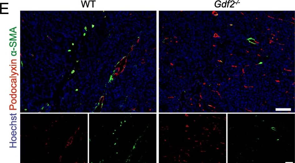 Gdf2 deletion decreases tumor perfusion and maturation in the E0771 mammary cancer model. E0771 cells were injected in the 4th mammary gland of WT and Gdf2−/− mice and tumor vascularization was analyzed 9 days after tumor detection. a Representative images of the tumors stained for podocalyxin (red), lectin (green) and cell nuclei (blue, Hoechst). Scale bar 50 μm. b Vascular density quantified by podocalyxin positive area (% of tumor area) and (c) assessment of vessel diameter using Ferret’s theorem (WT n = 7, Gdf2−/−n = 13, 1 representative experiment out of 2). d Quantification of vessel perfusion by lectin staining (% area of lectin/podocalyxin) (WT n = 8, Gdf2−/− n = 7, 1 representative experiment out of 3). e Representative images of the tumors stained for podocalyxin (red),  alpha -smooth muscle actin ( alpha -SMA) (green) and cell nuclei (blue, Hoechst). Scale bar 100 μm. f  alpha -SMA staining quantification (% area of  alpha -SMA/podocalyxin) (WT n = 8, Gdf2−/− n = 7, 1 representative experiment out of 3). b, c, d, f Data are the median ± interquartile range. Statistical analysis: Mann-Whitney test. *p ≤ 0.05 and **p ≤ 0.01 significantly different Image collected and cropped by CiteAb from the following publication (//pubmed.ncbi.nlm.nih.gov/30165893), licensed under a CC-BY license. Not internally tested by R&D Systems.