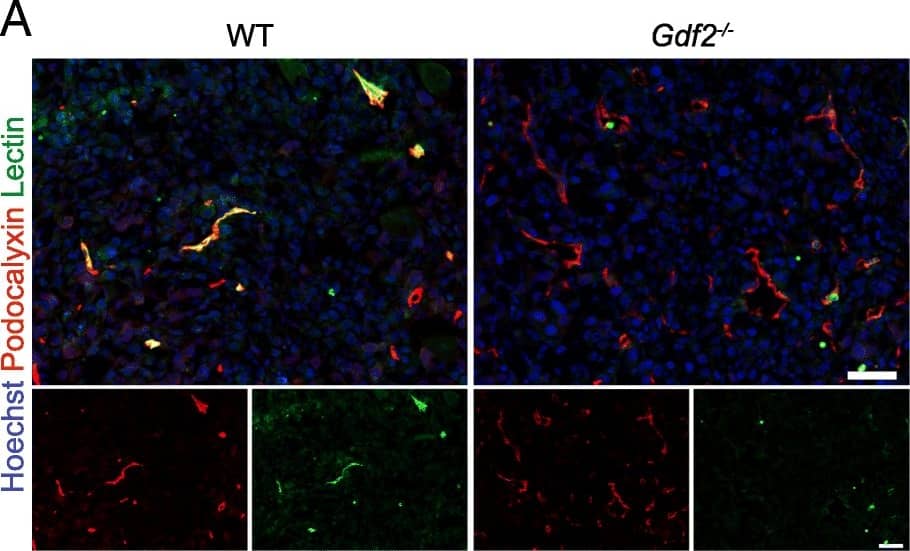 Gdf2 deletion decreases tumor perfusion and maturation in the E0771 mammary cancer model. E0771 cells were injected in the 4th mammary gland of WT and Gdf2−/− mice and tumor vascularization was analyzed 9 days after tumor detection. a Representative images of the tumors stained for podocalyxin (red), lectin (green) and cell nuclei (blue, Hoechst). Scale bar 50 μm. b Vascular density quantified by podocalyxin positive area (% of tumor area) and (c) assessment of vessel diameter using Ferret’s theorem (WT n = 7, Gdf2−/−n = 13, 1 representative experiment out of 2). d Quantification of vessel perfusion by lectin staining (% area of lectin/podocalyxin) (WT n = 8, Gdf2−/− n = 7, 1 representative experiment out of 3). e Representative images of the tumors stained for podocalyxin (red),  alpha -smooth muscle actin ( alpha -SMA) (green) and cell nuclei (blue, Hoechst). Scale bar 100 μm. f  alpha -SMA staining quantification (% area of  alpha -SMA/podocalyxin) (WT n = 8, Gdf2−/− n = 7, 1 representative experiment out of 3). b, c, d, f Data are the median ± interquartile range. Statistical analysis: Mann-Whitney test. *p ≤ 0.05 and **p ≤ 0.01 significantly different Image collected and cropped by CiteAb from the following publication (//pubmed.ncbi.nlm.nih.gov/30165893), licensed under a CC-BY license. Not internally tested by R&D Systems.