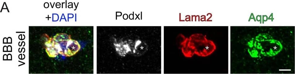 Endothelial  beta -catenin GOF does not affect the ECM of astrocytic endfeet and ECs within the subfornical organ (SFO).Striatal BBB-vessel showing a polarized distribution of Lama2 and Aqp4 in AC endfeet. Lumen is stained by Podxl (asterisk) (A). Coronal overview of the subfornical organ (SFO) (B); rectangular inset demarcates area for higher magnification in (C). Striatal BBB-vessel showing a polarized distribution of ColIV (green) but no Meca32 (white) in ECs (D). Coronal overview SFO, rectangular inset demarcates area for higher magnification in F (E); white dashed lines show Meca32+, red dashed lines show Meca32 vessels (F). Dashed lines outline SFO vessels; scale bars show 2 µm (A), 50 µm (B), 10 µm (C), 2.5 µm (D), 50 µm (E), 10 µm (F). Image collected and cropped by CiteAb from the following publication (//pubmed.ncbi.nlm.nih.gov/30932814), licensed under a CC-BY license. Not internally tested by R&D Systems.