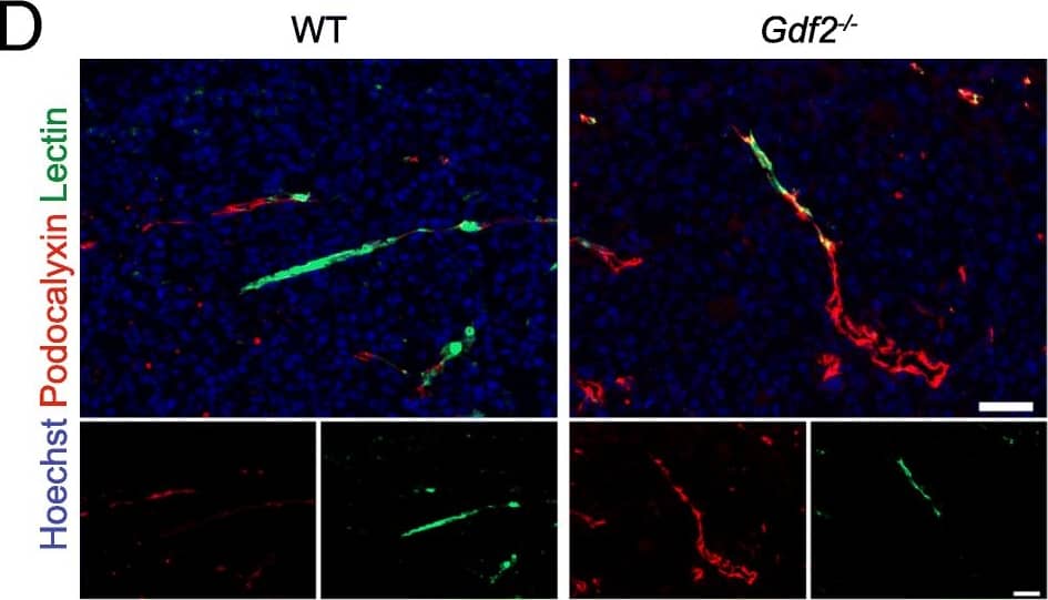 Bmp10 conditional deletion has no impact on tumor growth, angiogenesis and lung metastasis in the E0771 mammary cancer model. a Schematic representation of the experimental protocol for Bmp10 specific deletion and E0771 cells implantation. Tamoxifen was injected in all 3-week-old mice; 3 weeks later, E0771 cells were injected and tumor growth was analyzed for 3 weeks. b Plasmatic levels of BMP10 in control (CTL, n = 15) and Bmp10 conditional KO (Bmp10-cKO, n = 15) mice assessed by ELISA at the end of the experiment. c Tumor growth was assessed by caliper measurement every 2 to 3 days after tumor detection (CTL n = 7, Bmp10-cKO n = 8, 1 representative experiment out of 3). d Representative images of the tumors stained for podocalyxin (red), lectin (green) and cell nuclei (blue, Hoechst). Scale bar 50 μm. e Vascular density quantified by podocalyxin surface area (% of tumor area) and (f) Quantification of vessel perfusion by lectin staining (% area of lectin/podocalyxin) (CTL n = 7, Bmp10-cKO n = 8, 1 representative experiment out of 3). g Total area, (h) number and (i) mean size of lung metastases per mice bearing metastases (CTL n = 10, Bmp10-cKO n = 9, 2 experiments). c Data are the mean ± SEM. Statistical analysis: Two-way matched ANOVA. b, e, f, g, h, i Data are the median ± interquartile range. Statistical analysis: Mann-Whitney test. ****p ≤ 0.001 significantly different Image collected and cropped by CiteAb from the following publication (//pubmed.ncbi.nlm.nih.gov/30165893), licensed under a CC-BY license. Not internally tested by R&D Systems.