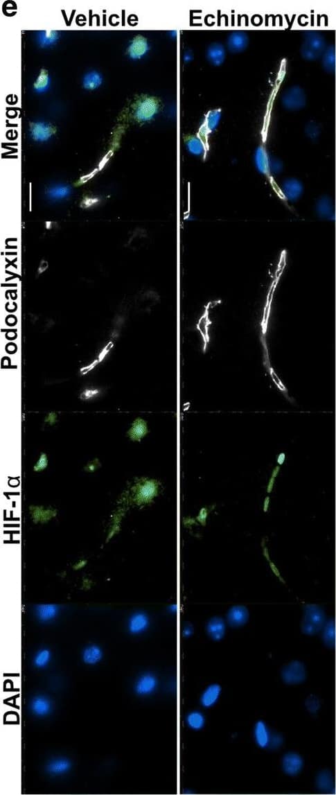 Improved survival&blood–brain barrier function post pneumococcal infection in mice by anti-HIF-1 alpha  treatment using echinomycin. e Immunofluorescence staining for HIF-1 alpha , BBB permeability&junctional markers in the echinomycin&vehicle groups at the survival end point. Left panel shows that echinomycin treatment leads to a reduction in HIF-1 alpha -positive nuclei including in ECs co-stained for podocalyxin, a vascular marker which was unchanged by the treatment. Middle panel displays reduced vascular permeability to fibrinogen in the echinomycin group as indicated by stronger intravascular signal compared to the vehicle-treated mice. Increased expression of tight junction proteins—occludin (middle panel)&claudin-5 (right top panel)—in echinomycin-treated mice indicate improved BBB function. Tight junction-associated ZO-1, adherens junction marker VE-Cadherin,&endothelial cell adhesion molecule CD31 unchanged (middle, bottom right panel). There was also no difference in S. pneumoniae (Spn) staining (right top panel) between the two groups. Scale bar 10 μm. Image collected & cropped by CiteAb from the following open publication (//pubmed.ncbi.nlm.nih.gov/32529267), licensed under a CC-BY license. Not internally tested by R&D Systems.