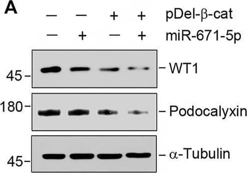 miR-671-5p aggravates  beta -catenin-induced podocyte injury while miR-671-5p inhibitor ameliorates it in vitro. (A–C) Representative Western blot (A) and graphic presentations of WT1 (B) and podocalyxin (C) were presented. MPC5 cells were transfected with miR-671-5p mimics (miR-671-5p) or/and  beta -catenin expression plasmid (pDel-beta -cat) for 24 h *p < 0.05 versus pcDNA3 controls; †p < 0.05 versus pDel-beta -cat (n = 3). (D–H) Representative Western blot (D) and graphic presentations of podocalyxin (E), nephrin (F), ZO-1 (G) and WT1 (H) were presented. MPC5 cells were transfected with  beta -catenin expression plasmid (pDel-beta -cat) or/and miR-671-5p inhibitor (AntimiR-671-5p) for 24 h *p < 0.05 (n = 3). (I) Representative micrographs show the expression of ZO-1 in different groups as indicated. MPC5 cells were transfected with  beta -catenin expression plasmid (pDel-beta -cat) and miR-671-5p mimics (miR-671-5p)/miR-671-5p inhibitor (AntimiR-671-5p) for 24 h, respectively. Scale bar, 50 µm. Image collected and cropped by CiteAb from the following open publication (//pubmed.ncbi.nlm.nih.gov/35111054), licensed under a CC-BY license. Not internally tested by R&D Systems.