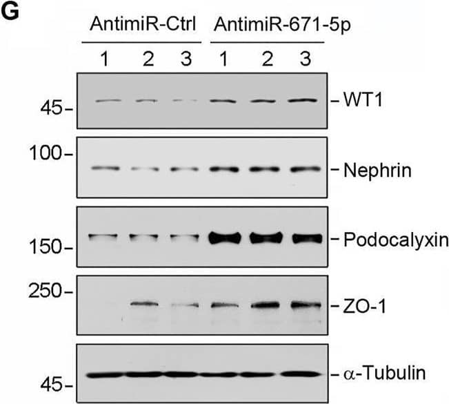 Overexpression of miR-671-5p impairs but knockdown of miR-671-5p protects podocyte integrity in vitro. Mouse podocytes (MPC5) were transfected with miR-671-5p mimics (miR-671-5p) or negative control (miR-Ctrl) for 24 h. (A) qRT-PCR analysis shows the relative levels of miR-671-5p after transfection. *p < 0.05 (n = 3). (B–E) Representative Western blot (B) and graphic presentations of WT1 (C), ZO-1 (D) and podocalyxin (E) were presented. *p < 0.05 (n = 3). (F) Representative micrographs show the expression and distribution of ZO-1 in podocytes after miR-671-5p overexpression. Scale bar, 50 µm. (G–K) Inhibition of miR-671-5p protects podocyte integrity. MPC5 cells were transfected with miR-671-5p inhibitor (AntimiR-671-5p) or control (AntimiR-Ctrl) or for 24 h. Representative Western blot (G) and graphic presentations of WT1 (H), nephrin (I), podocalyxin (J) and ZO-1 (K) were presented. *p < 0.05 (n = 3). Image collected and cropped by CiteAb from the following open publication (//pubmed.ncbi.nlm.nih.gov/35111054), licensed under a CC-BY license. Not internally tested by R&D Systems.