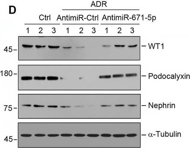 Inhibition of miR-671-5p reduces proteinuria and renal fibrotic lesions in ADR nephropathy. (A) Experimental design. Red Arrows indicate the time of ADR injection. Green arrows indicate the different time points of antagomir injections. (B) qRT-PCR analysis shows that miR-671-5p level was increased in ADR group compared with control, and injections of antimiR-671-5p decreased miR-671-5p level. *p < 0.05 versus normal controls; †p < 0.05 versus ADR (n = 5–6). (C) Inhibition of miR-671-5p reduces proteinuria in ADR nephropathy. Urinary albumin levels were assessed in mice at 2 weeks after ADR injection and expressed as mg/mg creatinine. *p < 0.05 versus normal controls; †p < 0.05 versus ADR (n = 5–6). (D–G) Representative Western blots (D) and graphic presentations of WT1 (E), podocalyxin (F) and nephrin (G) were presented. *p < 0.05 versus normal controls, †p < 0.05 versus ADR alone (n = 5–6). (H) Immunofluorescence staining shows that antimiR-671-5p preserved renal podocalyxin expression in ADR nephropathy. Arrow indicate positive staining. Scale bar, 20 µm. (I,J) Representative Western blots (I) and graphic presentations of fibronectin and  alpha -SMA (J) were presented. *p < 0.05 versus normal controls, †p < 0.05 versus ADR alone (n = 5–6). (K) Representative micrographs show that antimiR-671-5p inhibited  alpha -SMA expression (upper panel) and renal fibrotic lesions (bottom panel) in different groups as indicated. Scale bar, 50 µm. Image collected and cropped by CiteAb from the following open publication (//pubmed.ncbi.nlm.nih.gov/35111054), licensed under a CC-BY license. Not internally tested by R&D Systems.