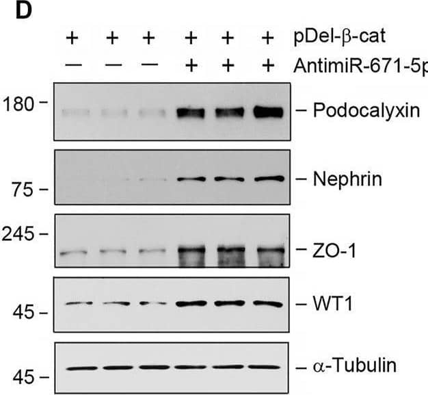 miR-671-5p aggravates  beta -catenin-induced podocyte injury while miR-671-5p inhibitor ameliorates it in vitro. (A–C) Representative Western blot (A) and graphic presentations of WT1 (B) and podocalyxin (C) were presented. MPC5 cells were transfected with miR-671-5p mimics (miR-671-5p) or/and  beta -catenin expression plasmid (pDel-beta -cat) for 24 h *p < 0.05 versus pcDNA3 controls; †p < 0.05 versus pDel-beta -cat (n = 3). (D–H) Representative Western blot (D) and graphic presentations of podocalyxin (E), nephrin (F), ZO-1 (G) and WT1 (H) were presented. MPC5 cells were transfected with  beta -catenin expression plasmid (pDel-beta -cat) or/and miR-671-5p inhibitor (AntimiR-671-5p) for 24 h *p < 0.05 (n = 3). (I) Representative micrographs show the expression of ZO-1 in different groups as indicated. MPC5 cells were transfected with  beta -catenin expression plasmid (pDel-beta -cat) and miR-671-5p mimics (miR-671-5p)/miR-671-5p inhibitor (AntimiR-671-5p) for 24 h, respectively. Scale bar, 50 µm. Image collected and cropped by CiteAb from the following open publication (//pubmed.ncbi.nlm.nih.gov/35111054), licensed under a CC-BY license. Not internally tested by R&D Systems.
