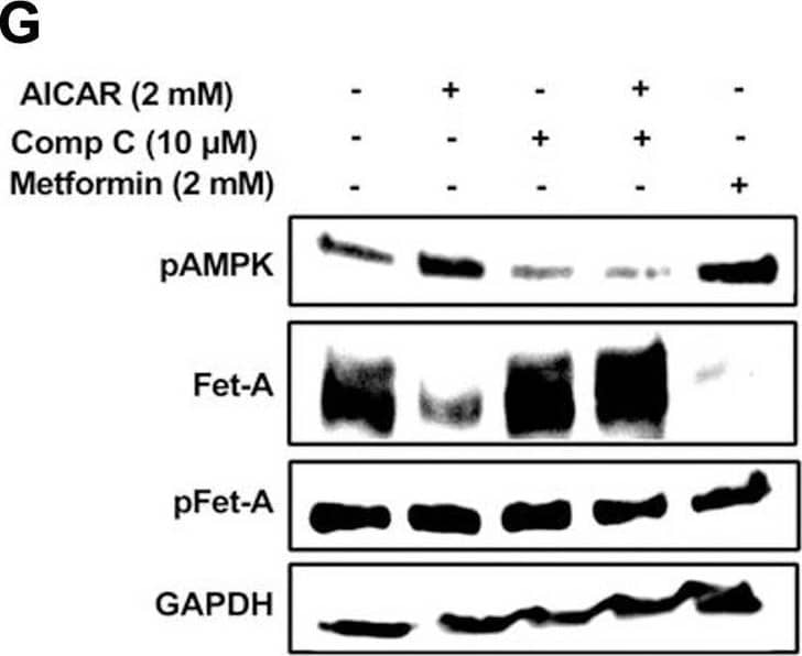 Activation of AMPK downregulates high glucose-induced Fet-A expression in HepG2 cells.[A] HepG2 cells were incubated in a media containing either mannitol, low glucose or high glucose for 12 hours, and cell lysates/media were subjected to immunoblotting for Fet-A and pFet-A (n = 3). [B] HepG2 cells were incubated with either low- or high-glucose in the absence or presence of AICAR for 12 h and cell lysates were analyzed by Western blotting. The blots were analyzed with antibodies against Fet-A (n = 4). [C] HepG2 cells were incubated with increasing concentrations (0.5, 1, 2 mM) of AICAR for 12 h. Cell lysate or media were analyzed by Western blotting for indicated proteins (n = 3) and [D] level of Fet-A and pFet-A in media, as a ratio of GAPDH were expressed. [E] HepG2 cells were incubated in low or high glucose in the absence or presence of AICAR/metformin for 12 hours, and media was used to detect Fet-A by ELISA technique (n = 4). [F] Real-time gene expression analysis was carried out for Fet-A after AICAR and metformin treatment (n = 4). [G] HepG2 cells were incubated with AICAR/metformin in the presence or absence of Compound C, an AMPK inhibitor. Cell lysates were immunoblotted for pAMPK, Fet-A as well as p-Fet-A and [H] Fet-A levels, as a ratio to GAPDH are depicted (n = 4). Data are shown as Means ± SEM. P values were determined by one-way ANOVA followed by Tukey’s multiple comparison tests (C-F). Data are representative of at least three independent experiments performed in replicates. * Indicates p < 0.05. Image collected and cropped by CiteAb from the following open publication (//pubmed.ncbi.nlm.nih.gov/35522655), licensed under a CC-BY license. Not internally tested by R&D Systems.