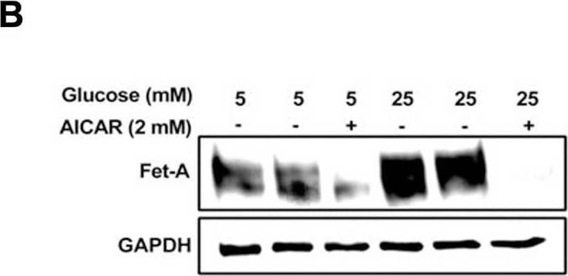 Activation of AMPK downregulates high glucose-induced Fet-A expression in HepG2 cells.[A] HepG2 cells were incubated in a media containing either mannitol, low glucose or high glucose for 12 hours, and cell lysates/media were subjected to immunoblotting for Fet-A and pFet-A (n = 3). [B] HepG2 cells were incubated with either low- or high-glucose in the absence or presence of AICAR for 12 h and cell lysates were analyzed by Western blotting. The blots were analyzed with antibodies against Fet-A (n = 4). [C] HepG2 cells were incubated with increasing concentrations (0.5, 1, 2 mM) of AICAR for 12 h. Cell lysate or media were analyzed by Western blotting for indicated proteins (n = 3) and [D] level of Fet-A and pFet-A in media, as a ratio of GAPDH were expressed. [E] HepG2 cells were incubated in low or high glucose in the absence or presence of AICAR/metformin for 12 hours, and media was used to detect Fet-A by ELISA technique (n = 4). [F] Real-time gene expression analysis was carried out for Fet-A after AICAR and metformin treatment (n = 4). [G] HepG2 cells were incubated with AICAR/metformin in the presence or absence of Compound C, an AMPK inhibitor. Cell lysates were immunoblotted for pAMPK, Fet-A as well as p-Fet-A and [H] Fet-A levels, as a ratio to GAPDH are depicted (n = 4). Data are shown as Means ± SEM. P values were determined by one-way ANOVA followed by Tukey’s multiple comparison tests (C-F). Data are representative of at least three independent experiments performed in replicates. * Indicates p < 0.05. Image collected and cropped by CiteAb from the following open publication (//pubmed.ncbi.nlm.nih.gov/35522655), licensed under a CC-BY license. Not internally tested by R&D Systems.