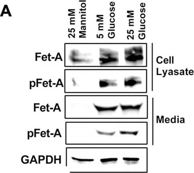 Activation of AMPK downregulates high glucose-induced Fet-A expression in HepG2 cells.[A] HepG2 cells were incubated in a media containing either mannitol, low glucose or high glucose for 12 hours, and cell lysates/media were subjected to immunoblotting for Fet-A and pFet-A (n = 3). [B] HepG2 cells were incubated with either low- or high-glucose in the absence or presence of AICAR for 12 h and cell lysates were analyzed by Western blotting. The blots were analyzed with antibodies against Fet-A (n = 4). [C] HepG2 cells were incubated with increasing concentrations (0.5, 1, 2 mM) of AICAR for 12 h. Cell lysate or media were analyzed by Western blotting for indicated proteins (n = 3) and [D] level of Fet-A and pFet-A in media, as a ratio of GAPDH were expressed. [E] HepG2 cells were incubated in low or high glucose in the absence or presence of AICAR/metformin for 12 hours, and media was used to detect Fet-A by ELISA technique (n = 4). [F] Real-time gene expression analysis was carried out for Fet-A after AICAR and metformin treatment (n = 4). [G] HepG2 cells were incubated with AICAR/metformin in the presence or absence of Compound C, an AMPK inhibitor. Cell lysates were immunoblotted for pAMPK, Fet-A as well as p-Fet-A and [H] Fet-A levels, as a ratio to GAPDH are depicted (n = 4). Data are shown as Means ± SEM. P values were determined by one-way ANOVA followed by Tukey’s multiple comparison tests (C-F). Data are representative of at least three independent experiments performed in replicates. * Indicates p < 0.05. Image collected and cropped by CiteAb from the following open publication (//pubmed.ncbi.nlm.nih.gov/35522655), licensed under a CC-BY license. Not internally tested by R&D Systems.