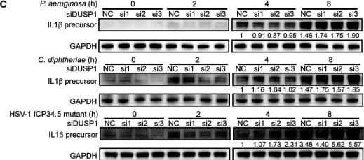 DUSP1 regulates p38 and JNK phosphorylation and the expression of innate immune response genes during bacterial and viral infections in RAW264.7 cells. (A) DUSP1 knockdown enhanced p38 and JNK phosphorylation during infection by P. aeruginosa, C. diphtheriae, HSV-1, or the HSV-1 ICP34.5 mutant. (B) DUSP1 knockdown enhanced the expression of the IL-1 beta , CSF3, TGM2, and SRC genes during infection by P. aeruginosa, C. diphtheriae, HSV-1, or the HSV-1 ICP34.5 mutant. (C) DUSP1 knockdown enhanced the protein level of IL-1 beta  during infection by P. aeruginosa, C. diphtheriae, or the HSV-1 ICP34.5 mutant. Image collected and cropped by CiteAb from the following open publication (//pubmed.ncbi.nlm.nih.gov/36625590), licensed under a CC-BY license. Not internally tested by R&D Systems.