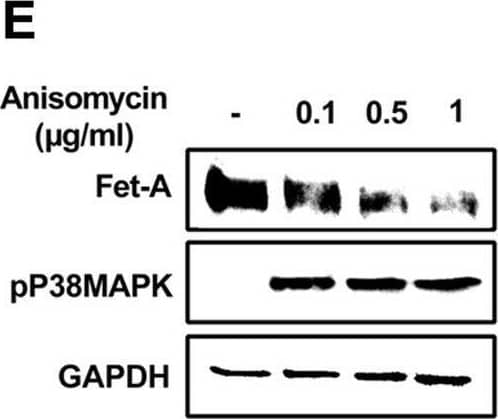 Effect of AICAR or anisomycin treatment on Fet-A expression in Hep3B cells and primary rat hepatocytes.[A] Hep3B cells were incubated in low or high glucose media with or without AICAR for 12 hours, and cell lysates were subjected to immunoblotting for Fet-A and phosphorylated Fet-A (n = 4). [B] High glucose-mediated changes in Fet-A level in Hep3B cells was expressed as a ratio to GAPDH. [C] Hep3B cells were incubated with different concentration of AICAR for 12 h and cell lysates were analyzed by Western blotting for indicated proteins (n = 3). [D] Effect of AICAR on Fet-A level in Hep3B cells was expressed as a ratio of GAPDH. [E] Hep3B cells were treated with various concentrations of anisomycin for 0.5 h to analyze phosphorylated p38 MAPK (pP38MAPK) and Fet-A expression (n = 3). [F] Effect of anisomycin on Fet-A level in Hep3B cells was expressed as a ratio of GAPDH [G] Primary rat hepatocytes were incubated with different concentration of AICAR for 12 h and cell lysate or media were analyzed by Western blotting for indicated proteins (n = 4). [H] Effect of AICAR in primary rat hepatocytes on Fet-A levels were expressed as ratio to GAPDH [I] primary rat hepatocytes were treated with anisomycin for 0.5 h to analyze phosphorylated p38 MAPK (pP38MAPK), Fet-A and p38MAPK expression (n = 4). [J] Effect of anisomycin in primary rat hepatocytes on Fet-A levels were expressed as ratio to GAPDH (n = 4). Data are shown as mean ± SEM. P values were determined accordingly by either by unpaired two-tailed test (E) or one-way ANOVA followed by Tukey’s multiple comparison tests (A-D). * Indicates p < 0.05. Image collected and cropped by CiteAb from the following open publication (//pubmed.ncbi.nlm.nih.gov/35522655), licensed under a CC-BY license. Not internally tested by R&D Systems.