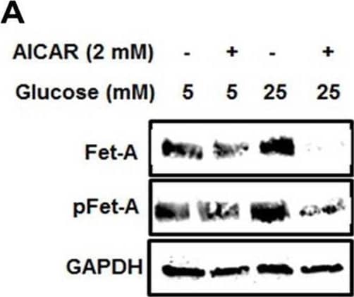 Effect of AICAR or anisomycin treatment on Fet-A expression in Hep3B cells and primary rat hepatocytes.[A] Hep3B cells were incubated in low or high glucose media with or without AICAR for 12 hours, and cell lysates were subjected to immunoblotting for Fet-A and phosphorylated Fet-A (n = 4). [B] High glucose-mediated changes in Fet-A level in Hep3B cells was expressed as a ratio to GAPDH. [C] Hep3B cells were incubated with different concentration of AICAR for 12 h and cell lysates were analyzed by Western blotting for indicated proteins (n = 3). [D] Effect of AICAR on Fet-A level in Hep3B cells was expressed as a ratio of GAPDH. [E] Hep3B cells were treated with various concentrations of anisomycin for 0.5 h to analyze phosphorylated p38 MAPK (pP38MAPK) and Fet-A expression (n = 3). [F] Effect of anisomycin on Fet-A level in Hep3B cells was expressed as a ratio of GAPDH [G] Primary rat hepatocytes were incubated with different concentration of AICAR for 12 h and cell lysate or media were analyzed by Western blotting for indicated proteins (n = 4). [H] Effect of AICAR in primary rat hepatocytes on Fet-A levels were expressed as ratio to GAPDH [I] primary rat hepatocytes were treated with anisomycin for 0.5 h to analyze phosphorylated p38 MAPK (pP38MAPK), Fet-A and p38MAPK expression (n = 4). [J] Effect of anisomycin in primary rat hepatocytes on Fet-A levels were expressed as ratio to GAPDH (n = 4). Data are shown as mean ± SEM. P values were determined accordingly by either by unpaired two-tailed test (E) or one-way ANOVA followed by Tukey’s multiple comparison tests (A-D). * Indicates p < 0.05. Image collected and cropped by CiteAb from the following open publication (//pubmed.ncbi.nlm.nih.gov/35522655), licensed under a CC-BY license. Not internally tested by R&D Systems.