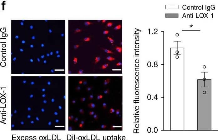 Immunocytochemistry/ Immunofluorescence LOX-1/OLR1 Antibody [Unconjugated] - C-terminus