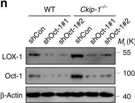Western Blot LOX-1/OLR1 Antibody [Unconjugated] - C-terminus