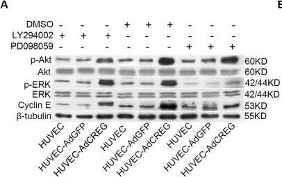 ERK, but not PI3K/Akt, mediates the increase of cyclin E induced by CREG overexpression in HUVEC. (A) Expression of p-ERK, ERK, p-Akt, Akt, cyclin E and  beta -tubulin was detected by Western blotting in the three groups of cells with LY294002 (50 μM) or PD098059 (20 μM) treatment. Vehicle (DMSO)-treated cells were used as control, and  beta -tubulin was used as a loading control; (B,C) Pooled analysis of the levels of Akt (B) and ERK (C) signaling activation accessed by the grayscale ratios of p-Akt/Akt and p-ERK/ERK, respectively. Data are given as the mean ± SD (n = 3). *p < 0.05; **p < 0.01. NS: no significant difference. (D) After normalization to  beta -tubulin, the difference in the expression of cyclin E between the HUVEC-AdGFP and HUVEC-AdCREG group was reduced by the treatment of PD098059, but not LY294002. Data are given as the mean ± SD (n = 3). **p < 0.01. NS: no significant difference. Image collected and cropped by CiteAb from the following open publication (//pubmed.ncbi.nlm.nih.gov/24018888), licensed under a CC-BY license. Not internally tested by R&D Systems.