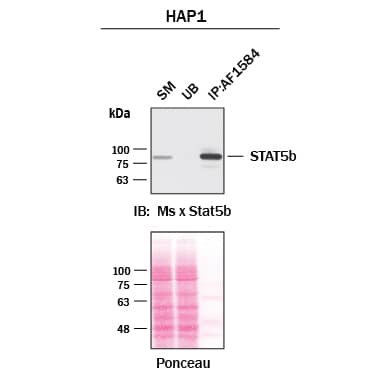 Immunoprecipitation STAT5b Antibody [Unconjugated]
