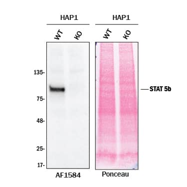 Knockout Validated STAT5b Antibody [Unconjugated]