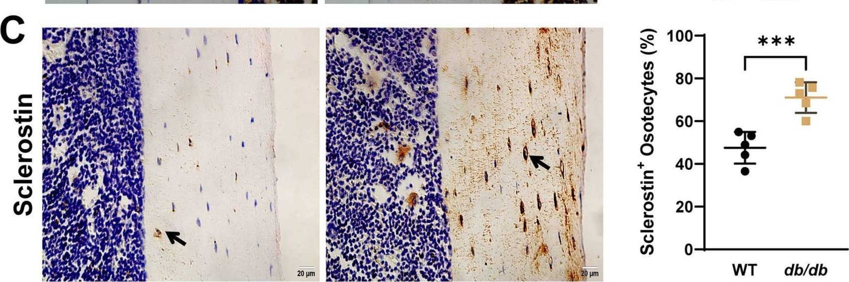 Localized sclerostin accumulation and increased expression of PLR-related proteins in 20-week-old male db/db diabetic mice cortical bone. Immunohistochemical staining shows increased expression of CTSK (A), MMP-13 (B), and sclerostin (C) within the osteocyte LCS of db/db mice compared to WT mice. Linear regression analysis (D) reveals a significant positive correlation between sclerostin expression and CTSK and MMP-13 using combined data from both groups. Data are presented as mean ± SD. Statistical analysis was performed using an unpaired Student’s t-test for (A–C) (n = 5 mice per group) and Pearson correlation for (D). *p < 0.05, **p < 0.01, ***p < 0.001. Image collected and cropped by CiteAb from the following open publication (//pubmed.ncbi.nlm.nih.gov/40352664), licensed under a CC-BY license. Not internally tested by R&D Systems.