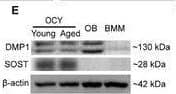 OCY‐EVs Transported to the Brain under Physiological & Pathological Conditions.Representative E) WB images of DMP1 & SOST expression. Scale bar: 100 µm.  beta ‐actin was used as loading control. OB, Osteoblast; BMM, bone marrow macrophage. n = 3 per group. Image collected & cropped by CiteAb from the following open publication (//pubmed.ncbi.nlm.nih.gov/35508803), licensed under a CC-BY license. Not internally tested by R&D Systems.