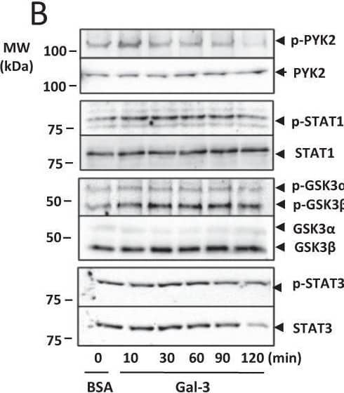 Western Blot GSK-3 alpha/beta [p Ser9, p Ser21, p Ser9] Antibody [Unconjugated]