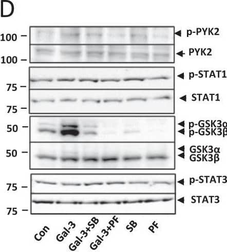 Western Blot GSK-3 alpha/beta [p Ser9, p Ser21, p Ser9] Antibody [Unconjugated]
