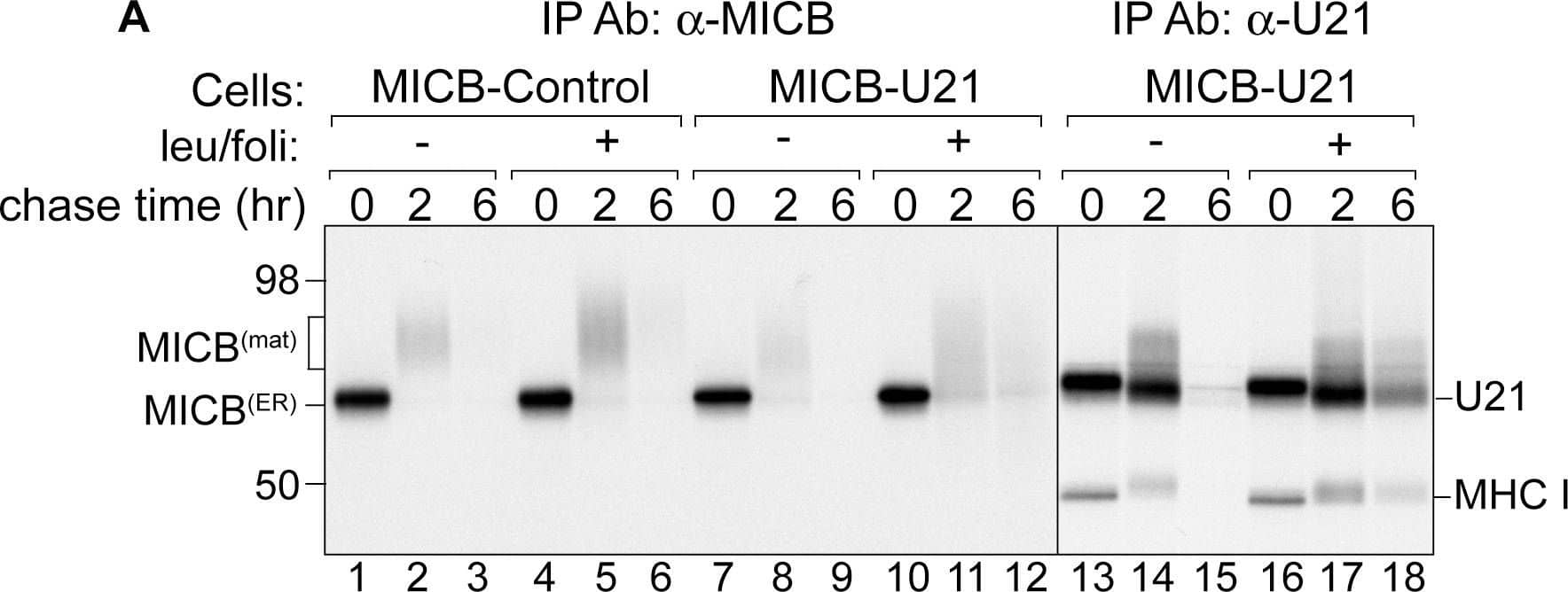 Western Blot MICB Antibody [Unconjugated]