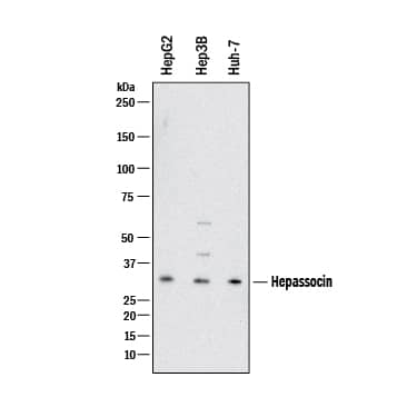 Western blot shows lysates of HepG2 human hepatocellular carcinoma cell line, Hep3B human hepatocellular carcinoma cell line, Huh‑7 human hepatoma cell line. PVDF membrane was probed with 1 µg/mL of Goat Anti-Human/Mouse/Rat Hepassocin/FGL1 Antigen Affinity-purified Polyclonal Antibody (Catalog # AF1614) followed by HRP-conjugated Anti-Goat IgG Secondary Antibody (HAF017). A specific band was detected for Hepassocin/FGL1 at approximately 34 kDa (as indicated). This experiment was conducted under reducing conditions and using Western Blot Buffer Group 1.