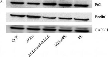 The effect of pitavastatin on AGEs-induced autophagy. Image collected and cropped by CiteAb from the following open publication (//pubmed.ncbi.nlm.nih.gov/29089470), licensed under a CC-BY license. Not internally tested by R&D Systems.