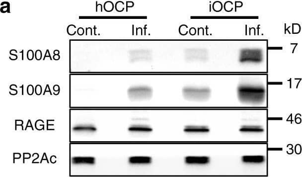 S100A8/A9 proteins augment differentiation and osteoclastic activity derived from iOCPs but not from hOCPs. a Expression of S100A8, S100A9 and RAGE in sorted control and inflamed BM iOCPs and hOCPs. The protein phosphatase 2A catalytic subunit (PP2Ac) is shown as a loading control. b Densitometry measurements of three biological repeats (no statistical analysis presented). c Sorted control and inflamed BM iOCPs and hOCPs (5 × 104) were cultured on the Osteo assay surface with or without anti-RAGE blocking antibodies (bar: 50 µm). d Pit area quantitation. e Sorted iOCPs and hOCPs (5 × 104) from the BM of control mice were cultured on the Osteo assay surface in combination with a recombinant S100A8/A9 heterodimer and anti-RAGE blocking antibodies as indicated (bar: 50 µm). f Pit area quantitation. c–f Depict representative results for two independent experiments, n = 5 for each group. Line: median, box: 25th-75th percentile, whiskers: range. *P < 0.05 (Mann–Whitney test and Holm multiplicity correction) Image collected and cropped by CiteAb from the following open publication (//pubmed.ncbi.nlm.nih.gov/35396510), licensed under a CC-BY license. Not internally tested by R&D Systems.