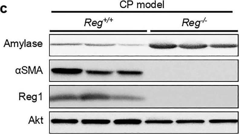 Reg deficiency led to the remission of chronic pancreatitis. (a) Representative pancreatic tissue section from mice of the indicated genotype at 8 weeks was stained with H&E or Azan (for collagen, dark blue) and Immunofluorescence staining of alpha-smooth muscle actin ( alpha SMA, an activated PSCs marker, red) (n = 5 mice). Scale bars: H&E, 50 μm; Azan, 100 μm (b) Pancreatic mRNA expression of proinflammatory cytokines interleukin 6(Il6), tumor necrosis factor a (Tnfa) and Il1b of indicated genotypes were assessed by qRT-PCR. The expression amounts of each gene were calculated relative to those of ribosomal protein S3 (Rps3) with the fold change to CP model_Reg+/+ mice. Mean ± SEM (n = 5 mice). Statistical analysis was performed by two-tailed unpaired Student t-test between two groups. *P < 0.05 (c) Cropped images of western blot gels of Amylase,  alpha SMA and Reg1 of the pancreas of indicated genotypes at 8 weeks and Akt was used as the loading control (n = 5 mice). The samples derived from the same experiment and gels were processed in parallel. Images of the entire gels and respective densitometric quantification analysis of the relative intensity of protein are presented in Supplementary Fig. 4,8. Image collected and cropped by CiteAb from the following open publication (//pubmed.ncbi.nlm.nih.gov/37500741), licensed under a CC-BY license. Not internally tested by R&D Systems.