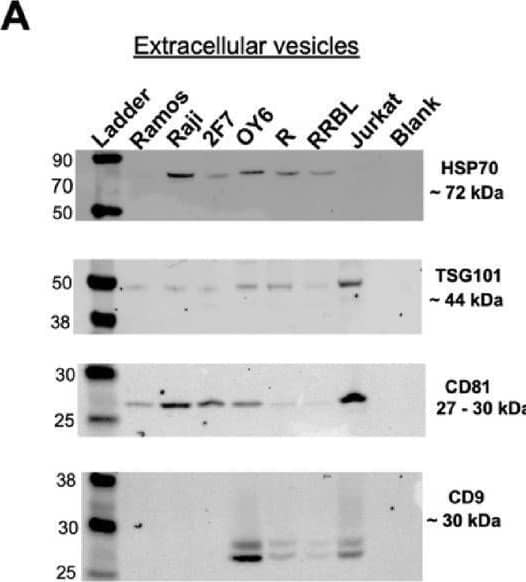 EVs isolated from NHL and AIDS-NHL cell lines sequester rituximab and inhibit apoptosis in Ramos cells. (A) Characterization of extracellular vesicles isolated from NHL and AIDS-NHL cell lines. Western blots of EVs demonstrate the presence of classic exosome markers: HSP70, TSG101, CD81, CD9, and (B) CD63. 20 µg of EV protein lysate was loaded into each well. Imaging/exposure times of each blot: CD81, 60 s; HSP70, 75 s; CD9, 60 s; TSG101, 40 s; and CD63, 60 s. (C) CD20 concentrations measured in EVs by ELISA. Data is for one Luminex assay run. (D) Ramos cells were treated with rituximab (3 µg/ml) in the presence or absence of EVs isolated from NHL (Raji, Ramos) or AIDS-NHL cell lines (2F7, RRBL, R) cell lines, including OY6, a lymphoblastoid cell line of AIDS-NHL. 30 µg of total EV protein was used for each treatment. Shown are representative flow cytometry plots of Ramos cells double stained with Propidium iodide (PI) and Annexin V-FITC after treatment with rituximab in the presence of 2F7 EVs or Raji EVs to evaluate subpopulations of cells undergoing apoptosis. Percentage values are shown in each quadrant of each plot. (E) Quantitative data presented as bar graphs showing the fold increase of apoptosis: Ratio of % double positive cells (PI + and Annexin V+) after treatment with rituximab/untreated Ramos cells. Results are from two to four independent experiments. Image collected and cropped by CiteAb from the following open publication (//pubmed.ncbi.nlm.nih.gov/40646161), licensed under a CC-BY license. Not internally tested by R&D Systems.