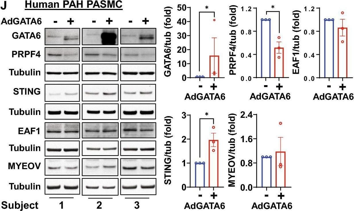 GATA6 deficiency is required for increased proliferation of human PAH PAEC & PASMC. (A-D) Human PAH PAECs were transfected with mock ( − ) (A,B), 10 MOI control adenovirus (C,D), or 10 MOI AdGATA6 for 48 h followed by immunoblot analysis (A), cell counts (B), proliferation (Ki67) (C), & apoptosis (Annexin V-FITC Apoptosis Staining/Detection Kit) (D) assays. Data are means ± SE from three (A–C) or four (D) experiments, each performed on  from different patient. *p < 0.05 by Mann Whitney U test. (E–H) Immunoblot analysis (E), cell counts (F), proliferation (Ki67) (G), & apoptosis (Annexin V-FITC Apoptosis Staining/Detection Kit) (H) assays of human PAH PASMC transfected with mock ( − ) (E,F), 10 MOI control adenovirus (G,H), or 10 MOI AdGATA6 for 48 h. Data are means ± SE from three (E–G) or four (H) experiments, each performed on  from different patient. *p < 0.05 by Mann Whitney U test. (I) RNA-sequencing analysis of adGATA6 & mock-transfected PAH PASMC (3 patients/group). RNA-sequencing data was normalized & clustered. Selected up & down-regulated gene clusters are shown. Genes further studied by immunoblot are boxed. Selected up- & down-regulated pathways identified by Gene Ontology analysis are shown (see supplemental Tables S2 & S3 for complete gene expression data). (J) Human PAH PASMC were transfected with mock ( − ) or 10 MOI AdGATA6 for 48 h followed by immunoblot analysis to detect indicated proteins. Data are means ± SE from three experiments, each performed on  from different patient. *p < 0.05 by Mann Whitney U test. (K) Immunoblot analysis of human healthy control (HC) & PAH PASMC to detect indicated proteins. Data are means ± SE from n = 4 subjects/group, *p < 0.05 by Mann Whitney U test. The original blots are presented in Supplementary Fig. S15. Image collected & cropped by CiteAb from the following open publication (//pubmed.ncbi.nlm.nih.gov/37087509), licensed under a CC-BY license. Not internally tested by R&D Systems.