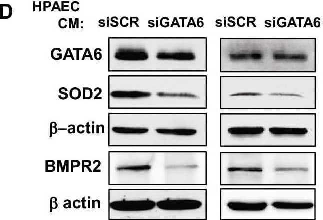 Endothelial GATA6 loss promotes GATA6 deficiency and increases growth of PASMC. (A) IHC stainings were performed to detect Gata6, CD31 and  alpha -SMA in WT and Gata6 CKO mice; images are representative from 3 mice/group. Bar = 50 μm. White arrowheads indicate Gata6-positive cells. (B) Schematic representation of experiments (C–F). Media conditioned for 72 h by non-diseased human PAEC (HPAEC) transfected with GATA6 siRNAs or control scr siRNA was added to non-diseased distal human PASMC. (C,D,E) mRNA (C) and immunoblot analyses (D,E) of PASMC after 72 h incubation with HPAEC-conditioned media (CM) were performed. Data are means ± SE from n ≥ 3 repetitions. *p < 0.05, **p < 0.01, ***p < 0.001 by Mann Whitney U test. (F) Cell growth (cell counts) assay of PASMC after 48 h incubation with indicated HPAEC conditioned media (CM). Data are means ± SE, n = 3. *p < 0.05 by Mann Whitney U test. (G,H) PASMC were incubated for 48 h with indicated HPAEC conditioned media (CM) in the presence of 10 nM control IgG, anti-fractalkine antibody (AB), or anti-TGF beta  AB. Schematic representation of experiment (G) and cell proliferation analysis (H) are shown. Data are means ± SE, n = 3–4/group. *p < 0.05 by Kruskal–Wallis test with post hoc Dunn’s test for multiple comparisons. The original blots are presented in Supplementary Fig. S18. Image collected and cropped by CiteAb from the following open publication (//pubmed.ncbi.nlm.nih.gov/37087509), licensed under a CC-BY license. Not internally tested by R&D Systems.