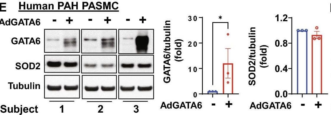 GATA6 deficiency is required for increased proliferation of human PAH PAEC & PASMC. (A-D) Human PAH PAECs were transfected with mock ( − ) (A,B), 10 MOI control adenovirus (C,D), or 10 MOI AdGATA6 for 48 h followed by immunoblot analysis (A), cell counts (B), proliferation (Ki67) (C), & apoptosis (Annexin V-FITC Apoptosis Staining/Detection Kit) (D) assays. Data are means ± SE from three (A–C) or four (D) experiments, each performed on  from different patient. *p < 0.05 by Mann Whitney U test. (E–H) Immunoblot analysis (E), cell counts (F), proliferation (Ki67) (G), & apoptosis (Annexin V-FITC Apoptosis Staining/Detection Kit) (H) assays of human PAH PASMC transfected with mock ( − ) (E,F), 10 MOI control adenovirus (G,H), or 10 MOI AdGATA6 for 48 h. Data are means ± SE from three (E–G) or four (H) experiments, each performed on  from different patient. *p < 0.05 by Mann Whitney U test. (I) RNA-sequencing analysis of adGATA6 & mock-transfected PAH PASMC (3 patients/group). RNA-sequencing data was normalized & clustered. Selected up & down-regulated gene clusters are shown. Genes further studied by immunoblot are boxed. Selected up- & down-regulated pathways identified by Gene Ontology analysis are shown (see supplemental Tables S2 & S3 for complete gene expression data). (J) Human PAH PASMC were transfected with mock ( − ) or 10 MOI AdGATA6 for 48 h followed by immunoblot analysis to detect indicated proteins. Data are means ± SE from three experiments, each performed on  from different patient. *p < 0.05 by Mann Whitney U test. (K) Immunoblot analysis of human healthy control (HC) & PAH PASMC to detect indicated proteins. Data are means ± SE from n = 4 subjects/group, *p < 0.05 by Mann Whitney U test. The original blots are presented in Supplementary Fig. S15. Image collected & cropped by CiteAb from the following open publication (//pubmed.ncbi.nlm.nih.gov/37087509), licensed under a CC-BY license. Not internally tested by R&D Systems.