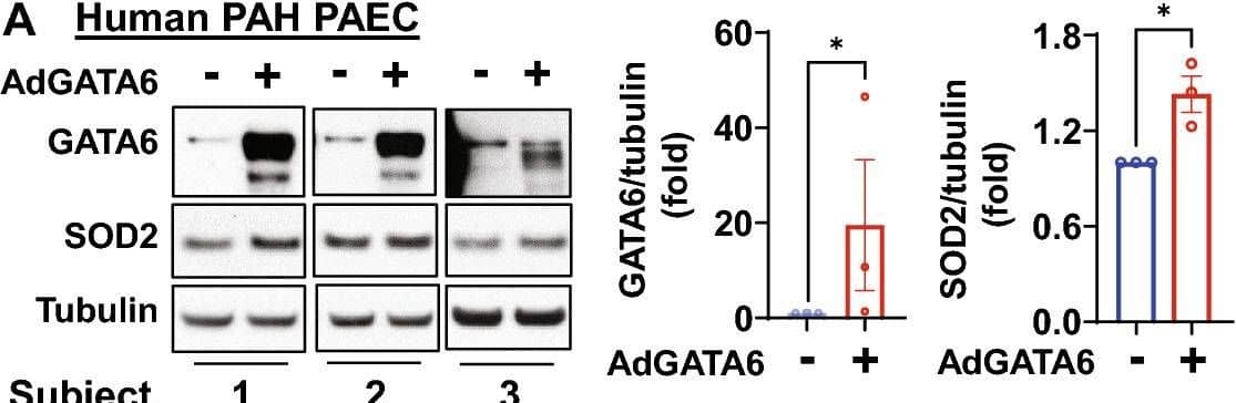 GATA6 deficiency is required for increased proliferation of human PAH PAEC & PASMC. (A-D) Human PAH PAECs were transfected with mock ( − ) (A,B), 10 MOI control adenovirus (C,D), or 10 MOI AdGATA6 for 48 h followed by immunoblot analysis (A), cell counts (B), proliferation (Ki67) (C), & apoptosis (Annexin V-FITC Apoptosis Staining/Detection Kit) (D) assays. Data are means ± SE from three (A–C) or four (D) experiments, each performed on  from different patient. *p < 0.05 by Mann Whitney U test. (E–H) Immunoblot analysis (E), cell counts (F), proliferation (Ki67) (G), & apoptosis (Annexin V-FITC Apoptosis Staining/Detection Kit) (H) assays of human PAH PASMC transfected with mock ( − ) (E,F), 10 MOI control adenovirus (G,H), or 10 MOI AdGATA6 for 48 h. Data are means ± SE from three (E–G) or four (H) experiments, each performed on  from different patient. *p < 0.05 by Mann Whitney U test. (I) RNA-sequencing analysis of adGATA6 & mock-transfected PAH PASMC (3 patients/group). RNA-sequencing data was normalized & clustered. Selected up & down-regulated gene clusters are shown. Genes further studied by immunoblot are boxed. Selected up- & down-regulated pathways identified by Gene Ontology analysis are shown (see supplemental Tables S2 & S3 for complete gene expression data). (J) Human PAH PASMC were transfected with mock ( − ) or 10 MOI AdGATA6 for 48 h followed by immunoblot analysis to detect indicated proteins. Data are means ± SE from three experiments, each performed on  from different patient. *p < 0.05 by Mann Whitney U test. (K) Immunoblot analysis of human healthy control (HC) & PAH PASMC to detect indicated proteins. Data are means ± SE from n = 4 subjects/group, *p < 0.05 by Mann Whitney U test. The original blots are presented in Supplementary Fig. S15. Image collected & cropped by CiteAb from the following open publication (//pubmed.ncbi.nlm.nih.gov/37087509), licensed under a CC-BY license. Not internally tested by R&D Systems.