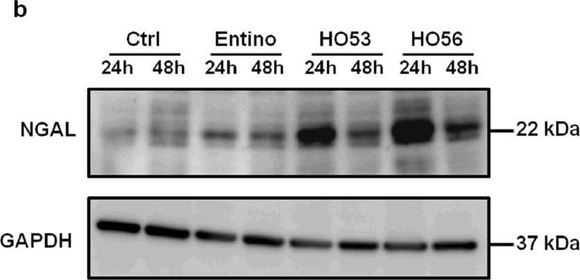 Western Blot Lipocalin-2/NGAL Antibody [Unconjugated]