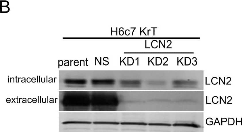 The knockdown and overexpression of LCN2 expression in PDAC cell lines.(A) LCN2 mRNA expression was suppressed using three different retroviral shRNA constructs (KD) in H6c7KrT cells. (B) Representative immunoblots of LCN2 protein expression in H6c7KrT cells, where GAPDH was used as a loading control. (C) LCN2 expression was downregulated in BxPC3 and HPAF-II cells. In PANC1 cells LCN2 was overexpressed by a lentiviral expression construct. (D) Representative immunoblots of LCN2 protein expression in BxPC3, HPAF-II, and PANC1 cells. Image collected and cropped by CiteAb from the following open publication (//pubmed.ncbi.nlm.nih.gov/23056397), licensed under a CC-BY license. Not internally tested by R&D Systems.