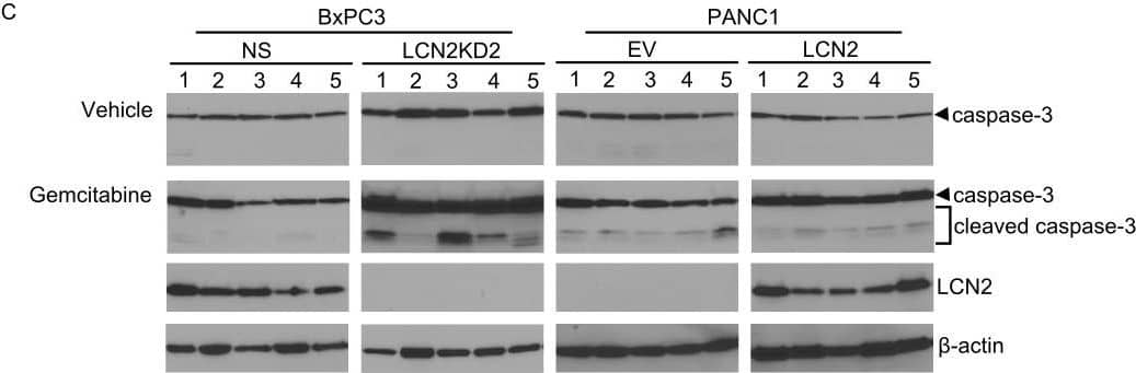 LCN2 promotes resistance to gemcitabine and angiogenesis.Effect of gemcitabine on the growth of tumors formed by (A) BxPC3-NS and –LCN2KD2 cell lines and (B) with PANC1-EV and –LCN2 cell lines [*denotes significance between vehicle treated cell lines (n = 10 per group, p<0.0001, mixed model multiple regression) †denotes significance between vehicle and gemcitabine treated mice injected with BxPC3 LCN2KD2 (n = 10 per group, p = 0.0003, mixed model multiple regression)]. (C) Protein lysates isolated from BxPC3 and PANC1 xenografts were assayed for caspase-3 cleavage after gemcitabine treatment (n = 10). (D) Representative histological images of xenografts formed by BxPC3 NS and –LCN2KD2, and PANC1-EV and –LCN2 cells after H&E, and immunostaining for LCN2, Ki67, and murine CD31. (E) Vascular density in five hot spots at high magnification in the BxPC3 NS and –LCN2KD2, and PANC1-EV and –LCN2 xenografts. The mRNA expression of (F) HIF1A and (G) VEGF in the BxPC3 and PANC1 xenografts. Gene expression was compared between KD and NS, or LCN2 and EV. [*denotes significance between KD and NS, or LCN2 and EV (n = 20; p<0.05, student t-test)]. Image collected and cropped by CiteAb from the following open publication (//pubmed.ncbi.nlm.nih.gov/23056397), licensed under a CC-BY license. Not internally tested by R&D Systems.