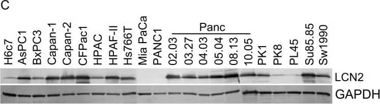 LCN2 expression in pancreatic neoplastic lesions and PDAC cell lines.(A) The LCN2 immunostaining pattern for normal (n = 31), PanIN1 (n = 22), PanIN-2 (n = 13), PanIN -3 and PDAC (n = 82). Mean scores and the SEM for LCN2 immunostaining are noted below the sections. (B) LCN2 gene expression was examined in 21 different PDAC cell lines. Relative expression was normalized using loading controls and then normalized to the H6c7 ratio. (C) Representative immunoblots of LCN2 and GAPDH protein expression in PDAC cell lines. Image collected and cropped by CiteAb from the following open publication (//pubmed.ncbi.nlm.nih.gov/23056397), licensed under a CC-BY license. Not internally tested by R&D Systems.