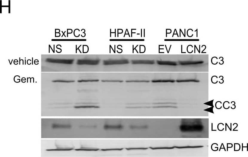 LCN2 promotes adhesion, invasion, and gemcitabine resistance in PDAC cells.Adhesion assays on the (A) H6c7 KrT, (B) BxPC3, HPAF-II, and PANC1 cell lines. Fold changes were calculated by comparing the KD to NS or LCN2 to EV (n = 3). The fold changes in invasive ability were calculated by comparing the effects of the shRNA constructs against the NS control, or LCN2 overexpression compared to the EV control. Invasive ability was assessed in (C) H6c7KrT cells (n = 3), (D) BxPC3, HPAF-II, and PANC1 cells (n = 6) were seeded onto Matrigel or collagen IV coated membranes. To assess MMP-9 activity gelatin zymography was performed on the conditioned media from (E) H6c7 KrT cells, (F) BxPC3, HPAF-II, and PANC1 cell lines (n = 3). (G) PI exclusion assays for cell death (n = 6) and (H) immunoblot analysis after 72 hours treatment by gemcitabine on the BxPC3, HPAF-II, and PANC1 cell lines (n = 3). (Gem., gemcitabine; C3, caspase 3; CC3, cleaved caspase 3; * denotes significant differences between the test and control samples student t-tests or one-way ANOVA and Bonferroni’s post hoc tests where appropriate.). Image collected and cropped by CiteAb from the following open publication (//pubmed.ncbi.nlm.nih.gov/23056397), licensed under a CC-BY license. Not internally tested by R&D Systems.