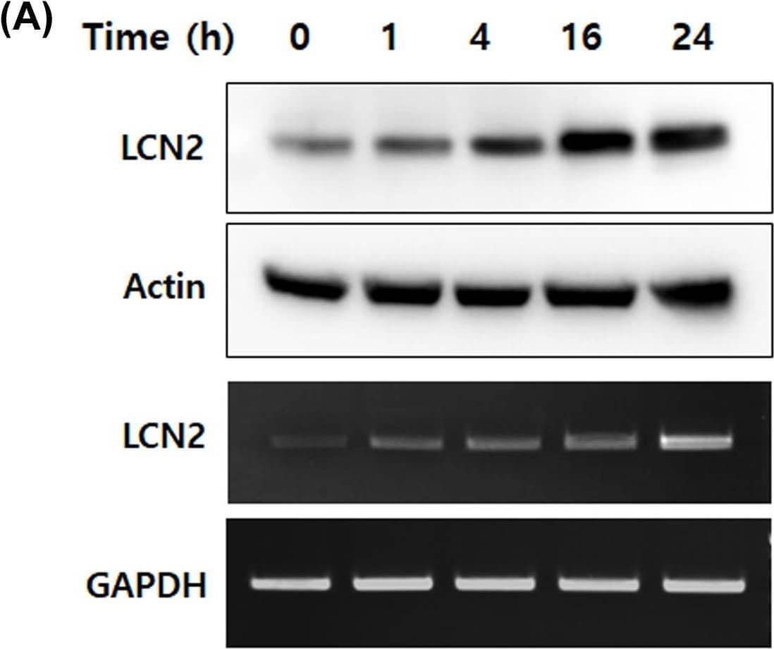 IL-6 specifically up-regulated LCN2 protein and mRNA levels in human CRC cells(A,B) After stimulation with IL-6, protein and mRNA of DLD-1 cells were isolated. Then, Western blotting and reverse-transcriptase PCR were performed. The top images are Western blots and lower images are reverse-transcriptase PCR. (C) Human CRC cell lines, SW480 and HT-29, were stimulated with 50 ng/ml IL-6 for 24 h, then the levels of LCN2 protein and mRNA were detected. All images are representatives from at least three independent experiments. Image collected and cropped by CiteAb from the following open publication (//pubmed.ncbi.nlm.nih.gov/35470375), licensed under a CC-BY license. Not internally tested by R&D Systems.