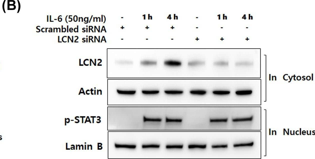 IL-6-specific up-regulation of LCN2 is dependent on STAT3 activation in human CRC cells(A) After stimulation with 50 ng/ml IL-6 for the indicated time, cytosolic and nuclear extracts of DLD-1 cells were prepared and used to determine the translocation of p-STAT3. Actin and lamin B were used as loading controls. (B) After transfection with LCN2 siRNA, DLD-1 cells were stimulated with 50 ng/ml IL-6. Then the level of LCN2 in cytosol and p-STAT3 in the nucleus were analyzed by Western blotting. Actin and lamin B were used as loading controls. (C) The cells were stimulated after transfection with STAT3 siRNA, then the level of LCN2 and p-STAT3 were analyzed by Western blotting (upper panel). After pretreatment with 5 μM stattic (STAT3-specific inhibitor), the cells were stimulated with IL-6. Then, the level of LCN2 and p-STAT3 were detected using Western blotting analysis (lower panel). Actin was used as a loading control. All images are representatives from at least three independent experiments. Image collected and cropped by CiteAb from the following open publication (//pubmed.ncbi.nlm.nih.gov/35470375), licensed under a CC-BY license. Not internally tested by R&D Systems.