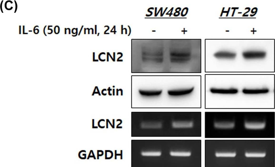 IL-6 specifically up-regulated LCN2 protein and mRNA levels in human CRC cells(A,B) After stimulation with IL-6, protein and mRNA of DLD-1 cells were isolated. Then, Western blotting and reverse-transcriptase PCR were performed. The top images are Western blots and lower images are reverse-transcriptase PCR. (C) Human CRC cell lines, SW480 and HT-29, were stimulated with 50 ng/ml IL-6 for 24 h, then the levels of LCN2 protein and mRNA were detected. All images are representatives from at least three independent experiments. Image collected and cropped by CiteAb from the following open publication (//pubmed.ncbi.nlm.nih.gov/35470375), licensed under a CC-BY license. Not internally tested by R&D Systems.
