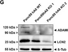 ADAM8 regulates LCN2 levels in tumor cell lines MB-231 and Panc89. The Human Protease/Protease Inhibitory Array demonstrates downregulation of ADAM8 (A), MMP-9 (B), and LCN2 (C) in supernatants derived from MB-231 hA8 KO cells. (D) mRNA expression and (E) representative Western blot of LCN2 in MB-231 hA8 WT and hA8 KO cells confirm results from (C) (n = 2). (F) mRNA expression and (G) representative Western blot of LCN2 in Panc89 hA8 WT, KO 1, and KO 2 cells demonstrate decreased LCN2 expression in hA8 KO cells (n = 2). Data are presented as mean values ± S.D., ** p < 0.01, *** p < 0.001. (H) Recombinant LCN2 (1 ng, 10 ng, 100 ng) does not affect protease activity of recombinant ADAM8 using a CD23 substrate (PepDAB# 13). Image collected and cropped by CiteAb from the following open publication (//pubmed.ncbi.nlm.nih.gov/35216088), licensed under a CC-BY license. Not internally tested by R&D Systems.