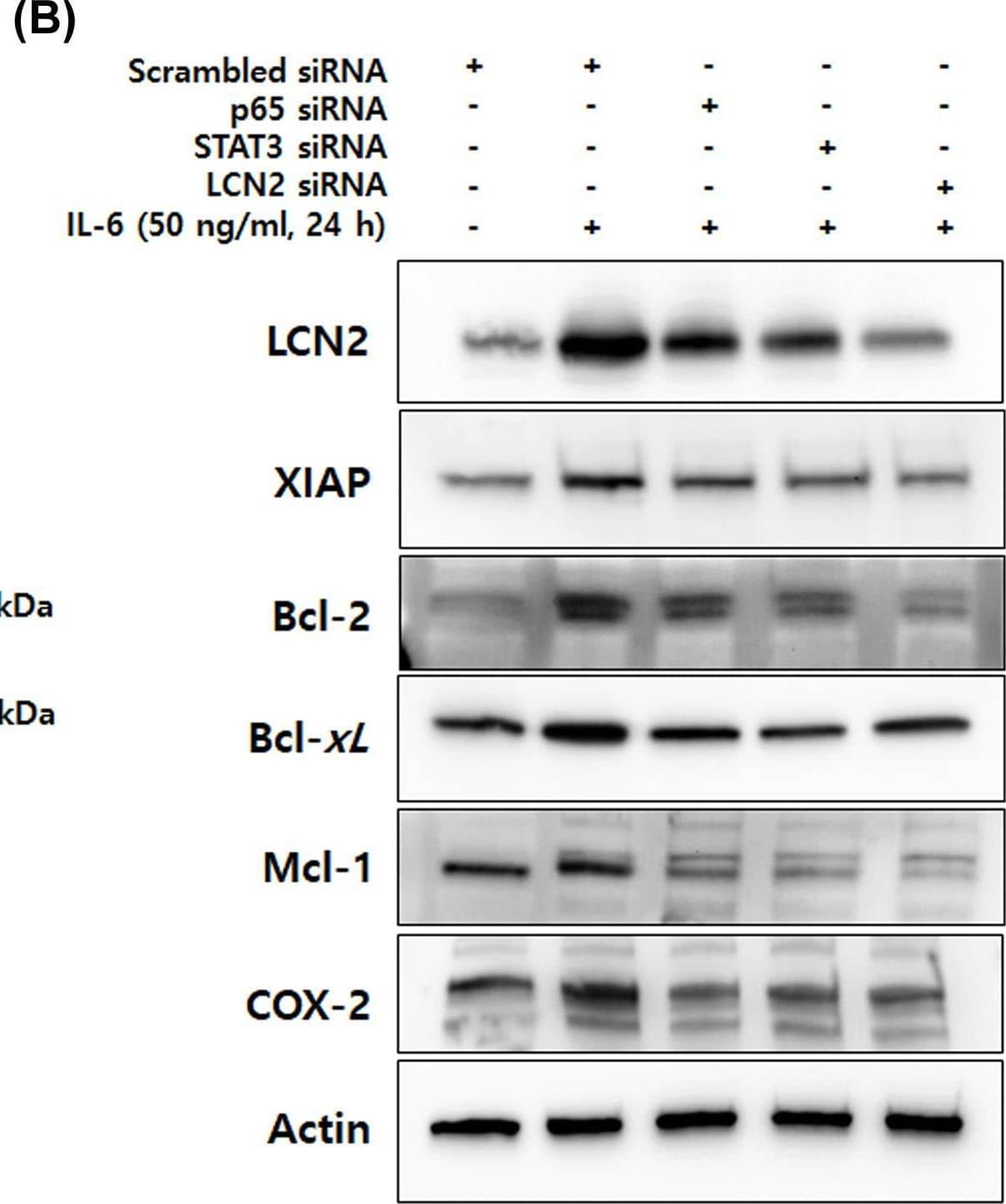 IL-6-induced LCN2 regulates cell survival and anti-apoptotic molecules mediated by the NF-kB/STAT3 pathway(A) After transfection with p65, STAT3 and LCN2 siRNA, DLD-1 cells were stimulated with 50 ng/ml IL-6 for 24 h, total extracts of DLD-1 cells were prepared and used to determine the phosphorylation of PI3k/AKT/mTOR. Actin was used as a loading control. (B) Total extracts prepared by the same methods were analyzed to determine the protein levels that are target gene products of STAT3 and NF-kB. Actin was used as a loading control. All images are representatives from at least three independent experiments. Image collected and cropped by CiteAb from the following open publication (//pubmed.ncbi.nlm.nih.gov/35470375), licensed under a CC-BY license. Not internally tested by R&D Systems.