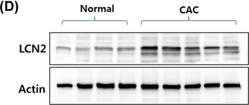 The expression of LCN2 was specifically induced in colon tissue of AOM/DSS-induced CAC mouse models The mice were given 7.4 mg/kg body weight of AOM and 3% DSS and subsequently killed (normal = 10, AOM/DSS = 12 mice). (A) Macroscopic appearance was captured for detecting tumor formation in the colon. (B) H&E staining (magnification ×10) of colonic mucosal tissue sections from mice were photographed using microscopy (upper panel). Colon length and body weight were statistically analyzed (lower panel). Data shown are presented as the mean ± SE. **P<0.01 versus control and CAC group. (C) After homogenizing colonic tissues, levels of LCN2 in tissue were detected by ELISA as described in the ‘Materials and methods’ section. Data shown are presented as the mean ± SE. **P<0.01 versus the control and CAC groups. (D) Total tissue extracts were prepared after killing and analyzed using LCN2 and actin antibody by Western blotting. Actin was used as a loading control. (E) IHC images of LCN2 expression in the colonic tissues from control and CAC mice are shown and the positively binding cells are shown in brown. The numbers of positive cells in the tumor samples were counted. Values represent means ± SEs. ***P<0.001 vs. the normal group. Image collected and cropped by CiteAb from the following open publication (//pubmed.ncbi.nlm.nih.gov/35470375), licensed under a CC-BY license. Not internally tested by R&D Systems.