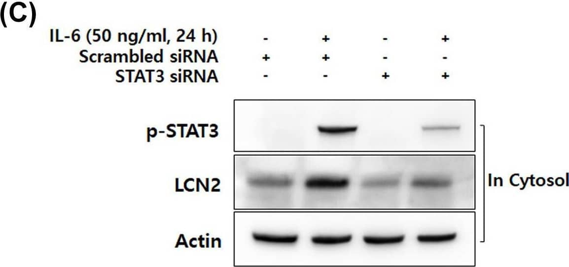 IL-6-specific up-regulation of LCN2 is dependent on STAT3 activation in human CRC cells(A) After stimulation with 50 ng/ml IL-6 for the indicated time, cytosolic and nuclear extracts of DLD-1 cells were prepared and used to determine the translocation of p-STAT3. Actin and lamin B were used as loading controls. (B) After transfection with LCN2 siRNA, DLD-1 cells were stimulated with 50 ng/ml IL-6. Then the level of LCN2 in cytosol and p-STAT3 in the nucleus were analyzed by Western blotting. Actin and lamin B were used as loading controls. (C) The cells were stimulated after transfection with STAT3 siRNA, then the level of LCN2 and p-STAT3 were analyzed by Western blotting (upper panel). After pretreatment with 5 μM stattic (STAT3-specific inhibitor), the cells were stimulated with IL-6. Then, the level of LCN2 and p-STAT3 were detected using Western blotting analysis (lower panel). Actin was used as a loading control. All images are representatives from at least three independent experiments. Image collected and cropped by CiteAb from the following open publication (//pubmed.ncbi.nlm.nih.gov/35470375), licensed under a CC-BY license. Not internally tested by R&D Systems.
