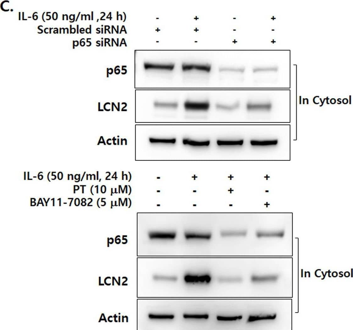 IL-6-specific up-regulation of LCN2 is dependent on NF-kappa B activation in human CRC cells(A) After stimulation with 50 ng/ml IL-6 for the indicated time, cytosolic and nuclear extracts of DLD-1 cells were prepared and used to determine the translocation of p65 from the cytosol to the nucleus. Actin and lamin B were used as loading controls. (B) After transfection with LCN2 siRNA, DLD-1 cells were stimulated with 50 ng/ml IL-6. Then the level of LCN2 in the cytosol and p65 in the nucleus were analyzed by Western blotting. Actin and lamin B were used as loading controls. (C) The cells were stimulated after transfection with p65 siRNA, then the levels of LCN2 and p65 were analyzed by Western blotting (upper panel). Cells were stimulated with IL-6 after pretreatment with PT and BAY11-7082 (NF-kappa B-specific inhibitor). Then, the levels of LCN2 and p65 were detected using Western blot analysis (lower panel). Actin was used as a loading control. All images are representatives from at least three independent experiments. Image collected and cropped by CiteAb from the following open publication (//pubmed.ncbi.nlm.nih.gov/35470375), licensed under a CC-BY license. Not internally tested by R&D Systems.